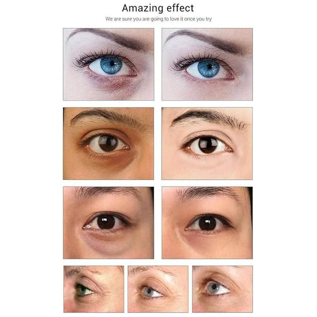 Under Eye Patches- Jakuva 30 Pairs Collagen Eye Masks Eye Patches for Dark Circles and Puffy Eyes, Reduce Wrinkles, Gel Ey...