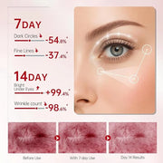 Peunitory Eye Balm, Under Eye Cream Brightener Balm Stick For Wrinkles Dark Circle Treatment Moisturizing Relief Skin Elas...