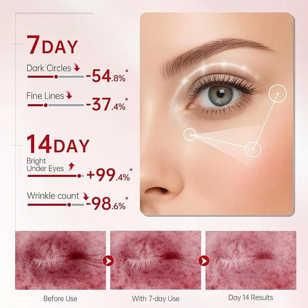 Peunitory Eye Balm, Under Eye Cream Brightener Balm Stick For Wrinkles Dark Circle Treatment Moisturizing Relief Skin Elas...