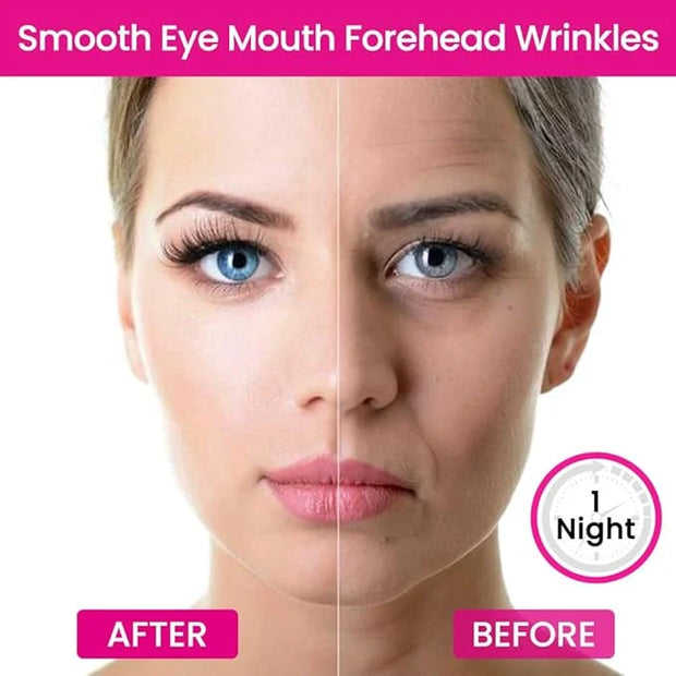 Kaely 256 Pcs Wrinkle Patches for Face Overnight, Silicone Scar Tape for Wrinkles Forehead, Face Tape for Wrinkles Overnig...
