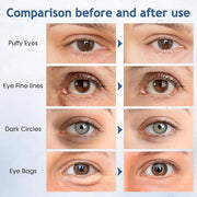 Under Eye Patches, 60 Pcs, Eye Mask for Puffy Eyes, Dark Circles, Eye Bags, Wrinkles, Collagen, Hyaluronic Acid, Castor Oi...