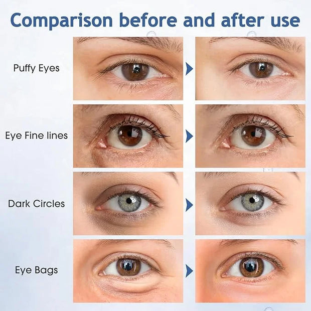 Under Eye Patches, 60 Pcs, Eye Mask for Puffy Eyes, Dark Circles, Eye Bags, Wrinkles, Collagen, Hyaluronic Acid, Castor Oi...