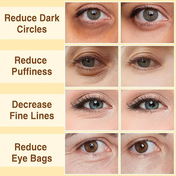 30Pcs Under Eye Collagen Patches, Moisturizing 24K Gold Eye Mask, Eye Patches for Puffy Eyes and Dark Circles, Under Eye M...