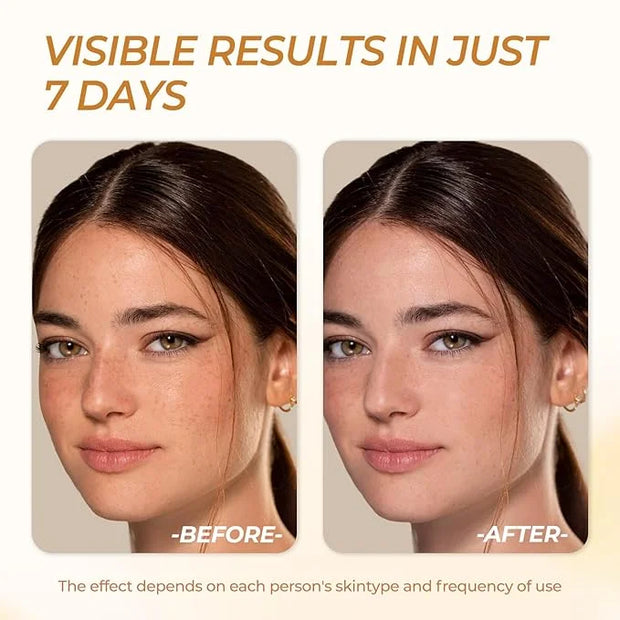 Deep Vitamin C Golden Capsule Hydrating Face Moisturizer, Antioxidant Protection, Lightweight Daily Skincare - Product Image