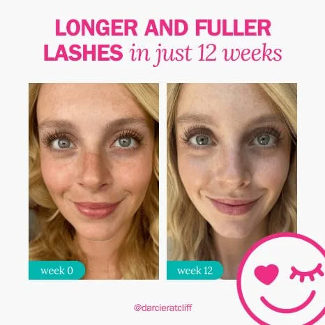 fLASH Eyelash Serum for Long, Curled Natural Lashes - Enhances & Strengthens, Safe & Effective Formula for Contact Wearers...