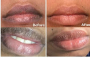 2PC Lip Balm Fade Dark Pigment