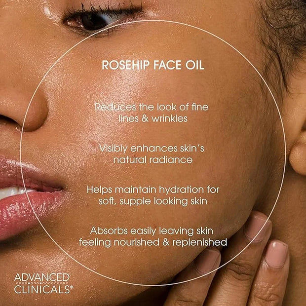Advanced Clinicals Rosehip Oil For Face With Vitamin E + Botanicals Helps Improve Look Of Dark Spots, Wrinkles, Fine Lines...