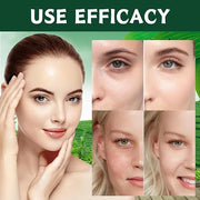Tea Tree Skincare Set Mother's Day Gifts - 5 Pcs Skin Care Set - Skincare for Girls 10-12 - Skin Care for Teens 10-12 - Gi...