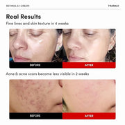 FRANKLY Skin Repair Duo: Retinol 0.3 Cream & Butter So Much Cream | Anti-Aging & Skin Turnover | Deep Moisturization | Veg...
