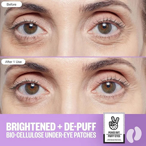 PEACE OUT Skincare Puffy Eyes, Biocellulose Under-Eye Mask, Minimize Puffiness & Tired Eyes with Caffeine and Niacinamide,...