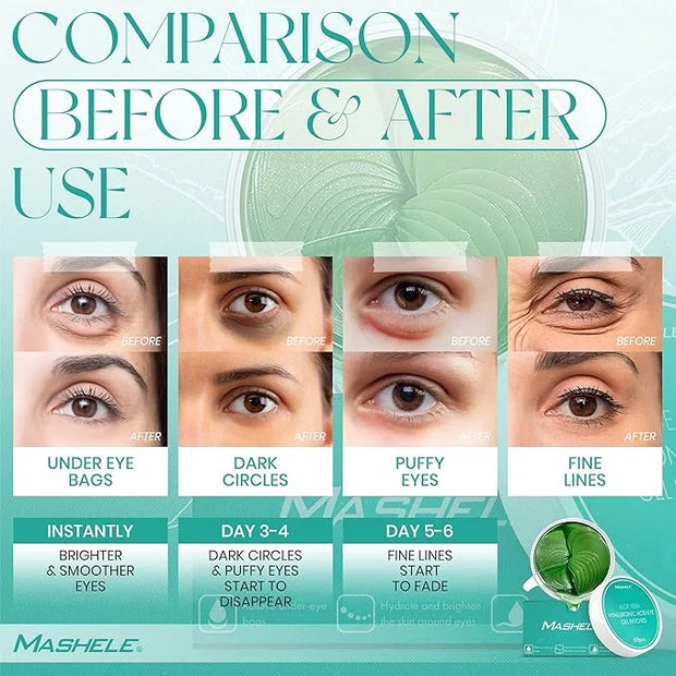 Korean 60pcs Aloe Vera Collagen Under Eye Gel Patches Mask, Treatment for Puffy Eyes, Dark Circles, Anti Wrinkle Pads, Moi...