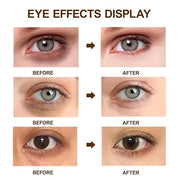Caffeine Eye Cream for Dark Circles,Under Eye Cream for Puffiness and Bags,Eye Cream Anti Aging for Men Women Reduce Wrink...