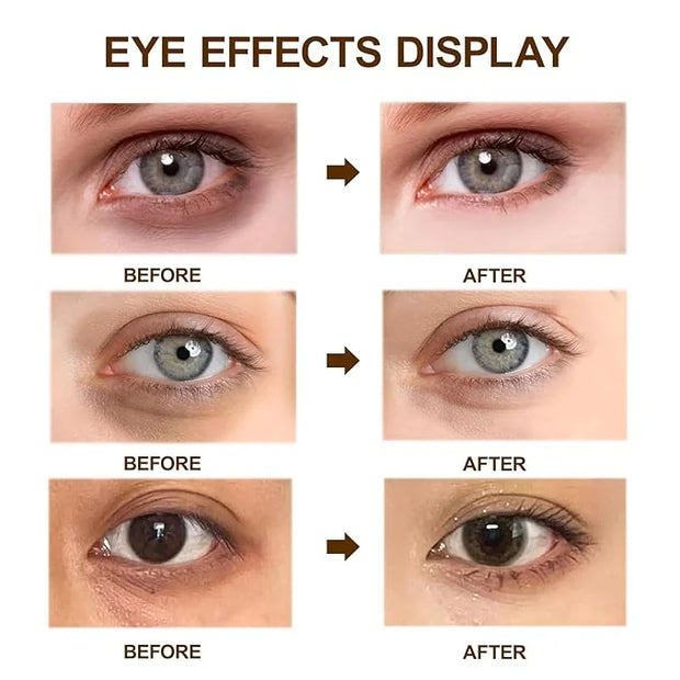 Caffeine Eye Cream for Dark Circles,Under Eye Cream for Puffiness and Bags,Eye Cream Anti Aging for Men Women Reduce Wrink...