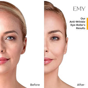 Eye roller serum acid hyaluronic