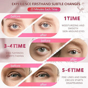 2 Packs 60 Pcs Under Eye Patches, 24K Gold+Pink, 30 Pairs Women Undereye Mask for Puffy Eyes Dark Circles Treatment, Men C...