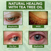 NOVEHA Tea Tree Oil Anti Wrinkle Eye Cream - Eyelid Cream for Dry & Itchy Skin, Scar | Moisturizer Face Cream Treatment - ...