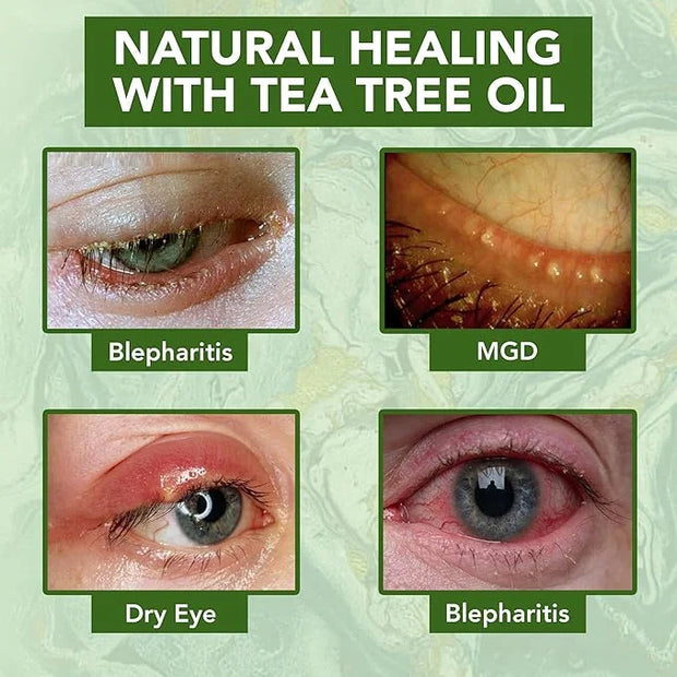 NOVEHA Tea Tree Oil Anti Wrinkle Eye Cream - Eyelid Cream for Dry & Itchy Skin, Scar | Moisturizer Face Cream Treatment - ...