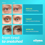 Under Eye Patches 12 Pairs of Themed Hydrogel Eye Gel Pads - For Puffy Eyes and Dark Circles, Under Eye Bags, Wrinkles - H...