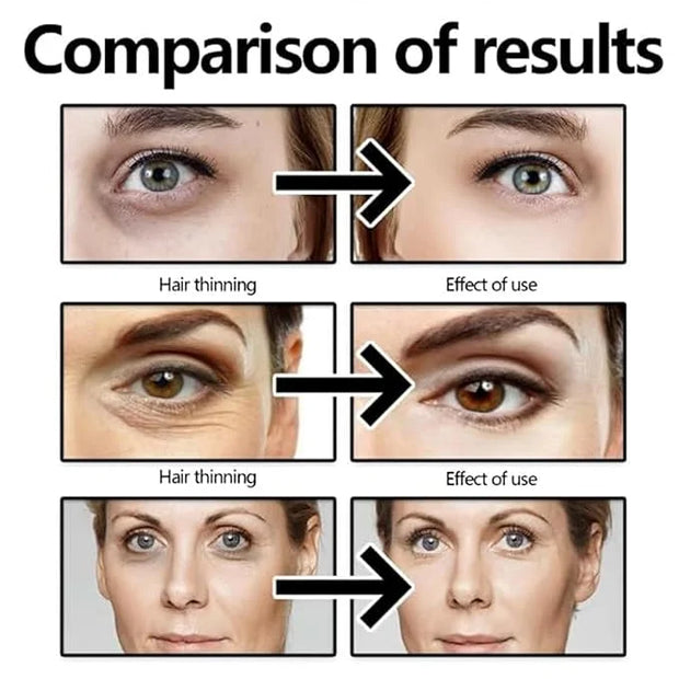 Kubot Instant Lift Eye Cream,Effective Instant Eye Lift,Multi Effect Firming and Tightening Under EyeCream,Under Eye Cream...