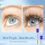Lash & Brow Growth Serum Kit - Visible Growth in 4 Weeks, 3-Month Supply, Natural Plant Extracts for Longer Eyelashes & Fu...