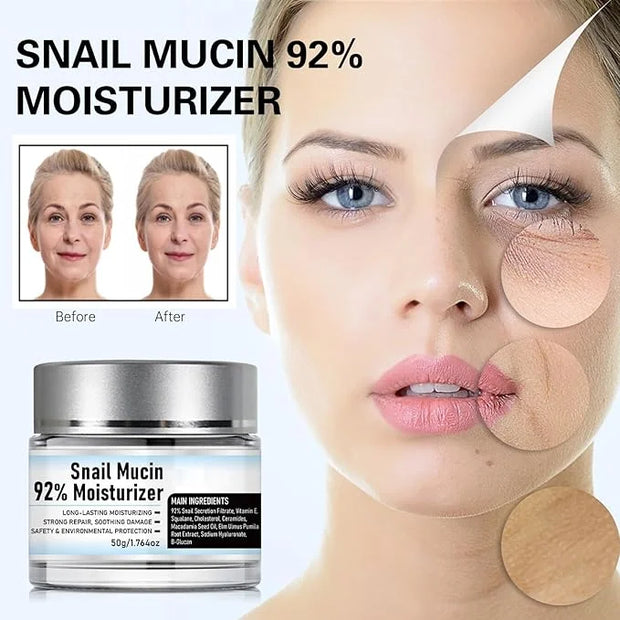 Snail Mucin 92% Moisturizer Daily Face Gel Cream, Hydrating Repair Face Gel Cream, Advanced Snail 92 All In One Cream for ...