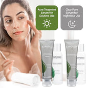 Exposed Skin Care Basic Acne Treatment Kit - Includes Salicylic Acid Face Wash, Clearing Tonic, Acne Treatment Serum with ...