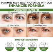 Eye Masks for Dark Circles and Puffiness – Hydrating Eye Patches with Collagen Hyaluronic Acid Green Tea & Aloe - Under Ey...