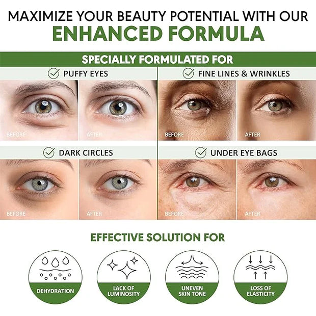 Eye Masks for Dark Circles and Puffiness – Hydrating Eye Patches with Collagen Hyaluronic Acid Green Tea & Aloe - Under Ey...