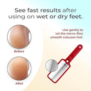 Microplane Colossal Foot File Scraper - The Original Stainless Steel Foot Rasp, Dead Skin/Callus Remover for Feet, Gentle ...