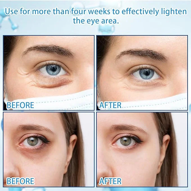5% Caffeine Eye Serum with 360° Massage Rollerball Topper,Caffeine Cream for Dark Circles,Wrinkles,Puffiness and Fine Line...