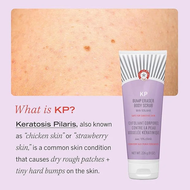 First Aid Beauty KP Bump Eraser Body Scrub 2 oz