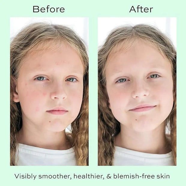 Face Moisturizer with Hyaluronic Acid Face Cream for Kids - Facial Cream & Gentle Moisturizer with Strawberry Extract & Vi...
