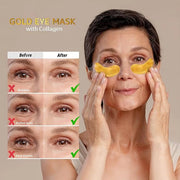 24k Gold Under Eye Mask, Reduce Puffy Eyes, Wrinkles And Undereye Bags (20 Pairs) Dark Circles Under Eye Treatment, Eye Co...