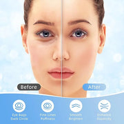 Under Eye Patches, 40 Pairs Eye Mask for Dark Circles, Puffy Eyes, Undereye Bags,Wrinkles,Eye Mask Patches with Hyaluronic...