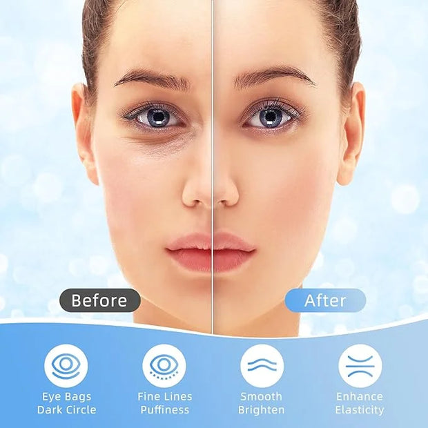 Under Eye Patches, 40 Pairs Eye Mask for Dark Circles, Puffy Eyes, Undereye Bags,Wrinkles,Eye Mask Patches with Hyaluronic...