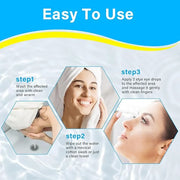 Stye Eye Treatment, Natural Stye Treatment Serum for Styes Chalazion and Blepharitis, Mild & Fast Relief - Product Image