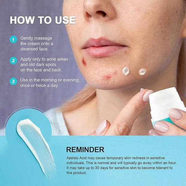 Acne Pimple Spot Treatment Cream: Cystic Hormonal Blackheads Blemish Remover for Face, Back and Body - with 10% Azelaic Ac...
