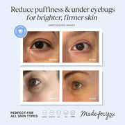 LilyAna Naturals Eye Cream for Dark Circles and Puffiness, Anti Aging Under Eye Cream for Wrinkles and Bags helps Improve ...
