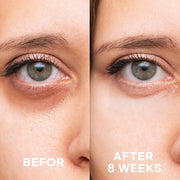 Epielle Firming Eye Cream | Anti-Aging Serum for Sagging Skin and Wrinkles | Cooling Applicator for Refreshing Application...