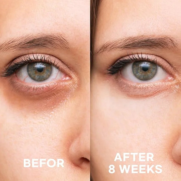 Epielle Firming Eye Cream | Anti-Aging Serum for Sagging Skin and Wrinkles | Cooling Applicator for Refreshing Application...