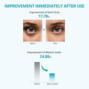 Re.SPN Bakuchiol Firming Roller Eye Cream, Niacinamide, Retinol, Adenosine, Caffeine | Self-Care, Vegan, Intense Hydration...