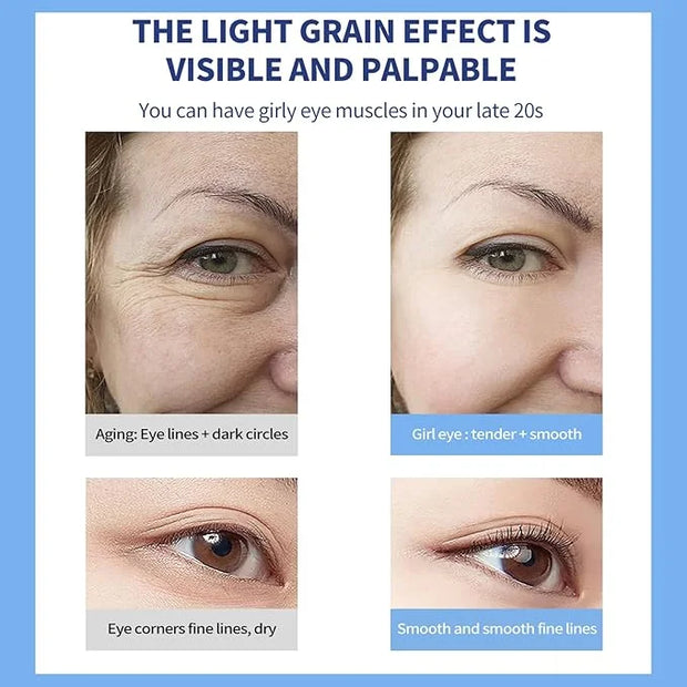 O'CHEAL Eye Cream with Vibrating Electric Massage Head- Hydrating, Brightens, Tightens, Reduces Dark Circles & Wrinkles, B...