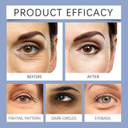 Malora & Novalift Microglow Eye Patches, Renford & Baani Hyaluronic Patches for Under Eyes Bags and Wrinkles, Elegear Wome...