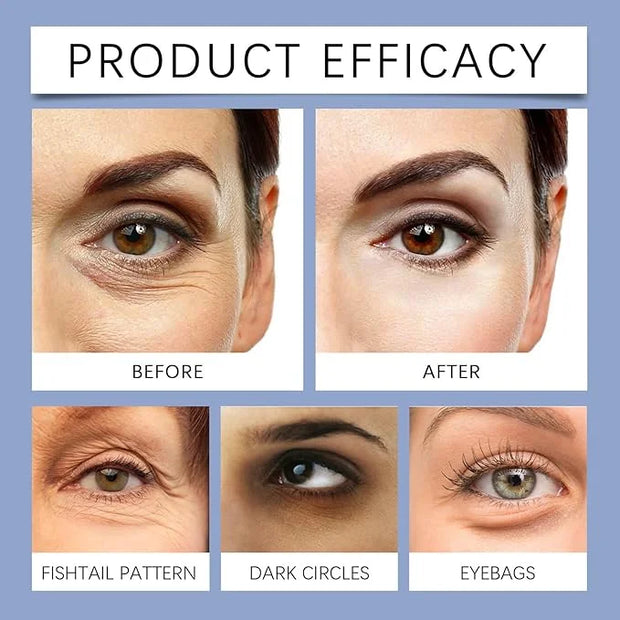 Malora & Novalift Microglow Eye Patches, Renford & Baani Hyaluronic Patches for Under Eyes Bags and Wrinkles, Elegear Wome...