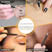 Tweezers For Ingrown Hair By The Razor Bump Co. | Sharp, Stainless Steel, Surgical | Professional Tweezers For Women and M...