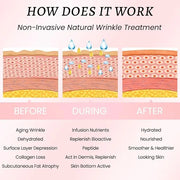 Kaely 128 Pcs Wrinkle Patches for Face Overnight, Silicone Scar Tape for Wrinkles Forehead, Face Tape for Wrinkles Overnig...