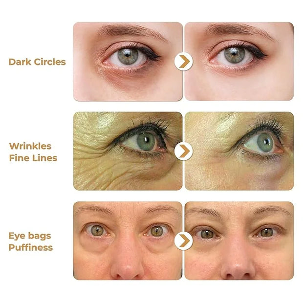 ABERA Natural Repair Eye Cream, Minimizes Under Eye Bags & Puffiness, Reduce Wrinkles, Fine Lines and Dark Circles, 0.5 fl...