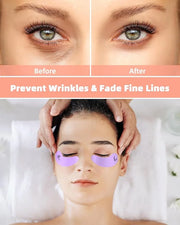 Under Eye Patches Silicone - 5 Pairs Reusable Eye Wrinkle Patches, Reusable Under Eye Mask, Plump Fine Lines & Wrinkles - ...