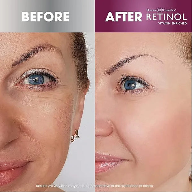 Retinol Anti-Aging Day Cream Broad Spectrum SPF 20 Moisturizes & Reduces Look of Fine Lines Anti-Aging Eye Gel Pads – Soot...