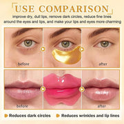CAHIUYOA 30PCS Lip Mask and Under Eye Masks Set,Pink Lip Masks for Dry Lips 24K Gold Eye Patches for Puffy Eyes,Effective ...